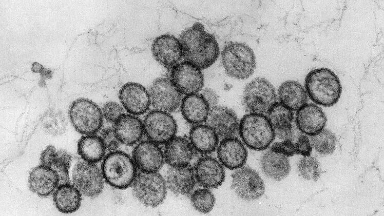 Hantavirus