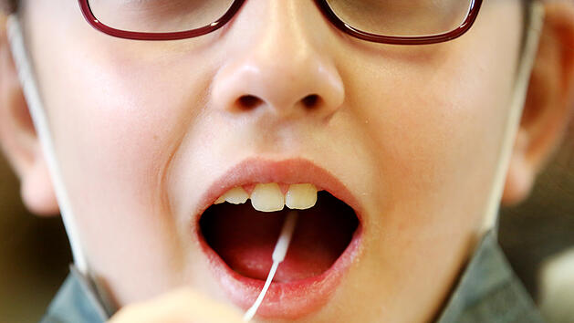 Corona bei Kindern verläuft fünfmal häufiger ohne Symptome als bei Erwachsenen.