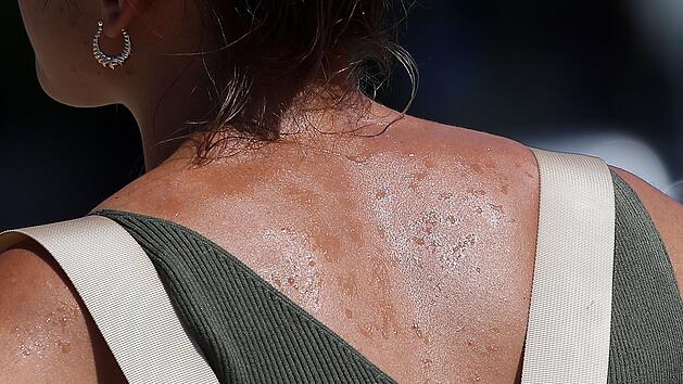 Warum Hitzewellen auch nach Tagen noch gef&auml;hrlich sind