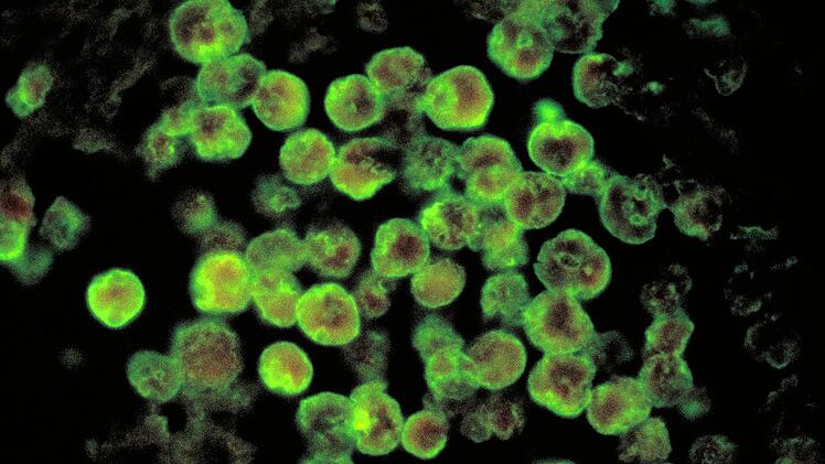 Naegleria fowleri