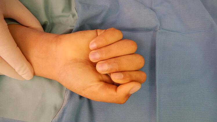 Von der geschlossenen zur wieder funktionsfähigen Hand  Foto: Klinikum Kulmbach