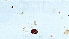 Auf einem weißen Blatt Papier ist in der Bildmitte die abgestorbene, dunkel glänzende, knapp zwei Millimeter große Milbe neben winzigen Tröpfchen von Feuchtigkeit oder Wachsstückchen gut zu erkennen.  Fotos: Ramona Popp