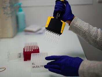 Wenn Hepatitis C-Viren im Blut entdeckt werden, lässt sich die Infektion in der Regel mit Medikamenten heilen.