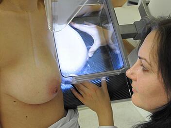 Die Brust einer Frau wird am von Assistentin Maria Stein (r) für die Untersuchung an einem neuen digitalen Mammographie-Gerät zur Brustkrebsfrüherkennung vorbereitet.