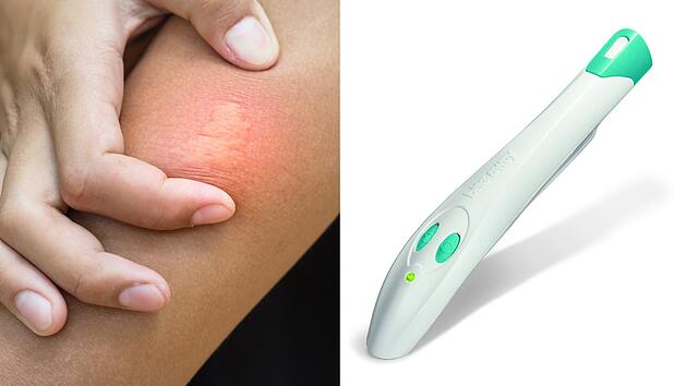 Elekronischer Stichheiler Bite-Away im Test