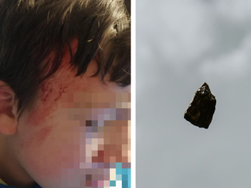 W&uuml;stenahorn: Junge (13) wird wohl mit Stein angegriffen - Vater erstattet Anzeige