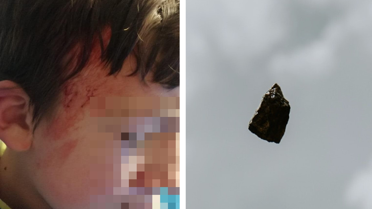 W&uuml;stenahorn: Junge (13) wird wohl mit Stein angegriffen - Vater erstattet Anzeige