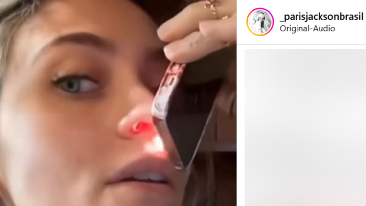 Paris Jackson zeigt schockierende Folge ihres Drogenkonsums