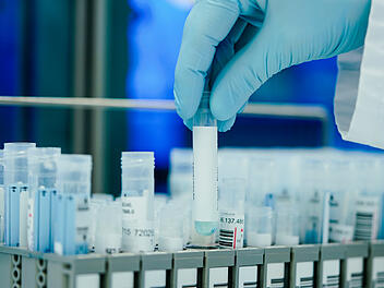 PCR-Test