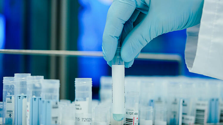 PCR-Test