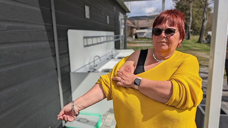 Neben dem Sanit&auml;tshaus stand Beate Rau am Sp&uuml;lbecken. Ein  Schuss f&auml;rbte ihren Arm sichtbar blau.