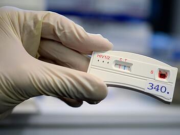 Dank moderner Tests und pharmazeutischem Fortschritt kann ein HIV-Infizierter ein weitgehend normales Leben führen.dpa
