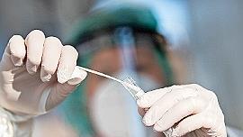 Zur Ermittlung der Kontaktpersonen bei positivem Corona-Test gibt es eine neue Strategie.