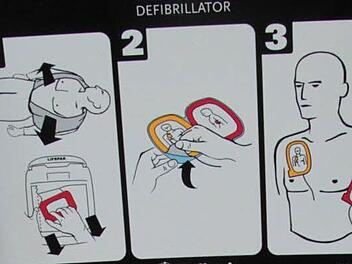 Die Handhabung eines Defibrillators ist ganz simple. Foto: Jürgen Gärtner