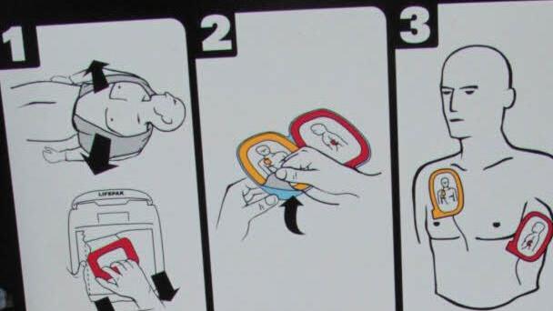 Die Handhabung eines Defibrillators ist ganz simple. Foto: Jürgen Gärtner