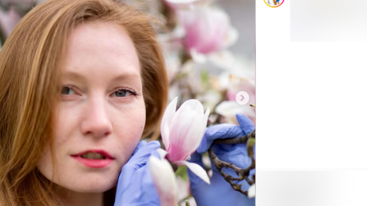 W&uuml;rzburgerin ist "Miss Germany"-Kandidatin: Sie z&uuml;chtet menschliche Haut