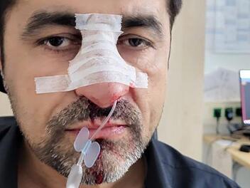 Bayreuth: Lokalpolitiker schildert rassistischen Angriff - "wie in schlechtem Hollywood-Film" Bayreuth: Lokalpolitiker schildert rassistischen Angriff - "wie in schlechtem Hollywood-Film"