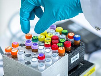 Zwei Menschen an Ehec gestorben