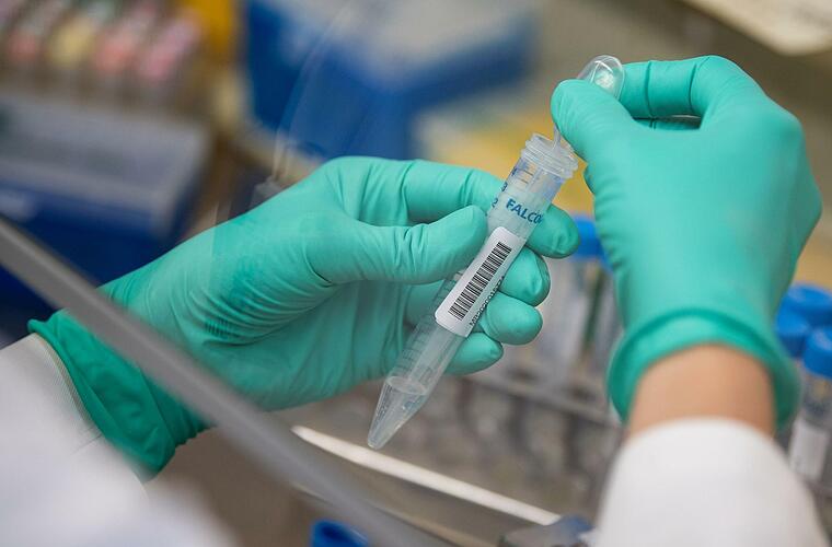 Crispr-Methode: Wird die Verbreitung des Coronavirus so bald ganz gestoppt? - Vimarsana News