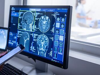 FAU Erlangen mit spannendem Projekt: Schlagen Implantate bald gegen Krebs Alarm?