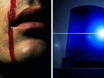 Coburg: Passanten melden blutverschmierten Mann in der Innenstadt - offene Wunde am Hals Coburg: Passanten melden blutverschmierten Mann in der Innenstadt - offene Wunde am Hals