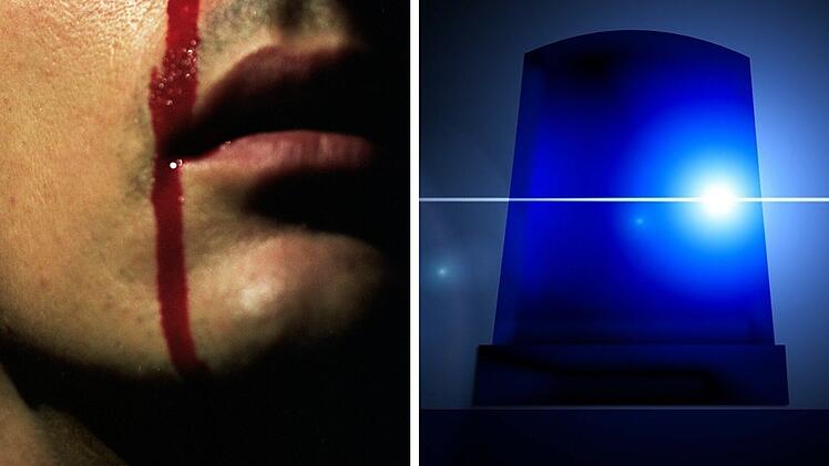 Coburg: Passanten melden blutverschmierten Mann in der Innenstadt - offene Wunde am Hals