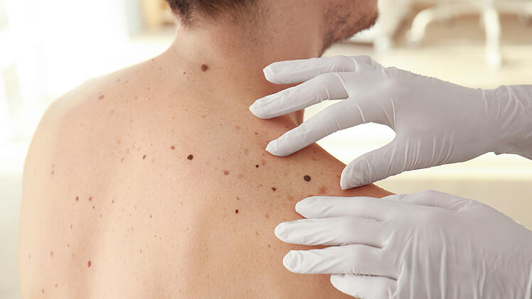 Dermatologe bei der Untersuchung eines Patienten in der Klinik, Dermatoskopie, Prävention von Melanomen, Hautkrebs.